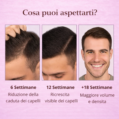 Siero PuraDama™ HairDensity | Siero roll-on per la crescita dei capelli