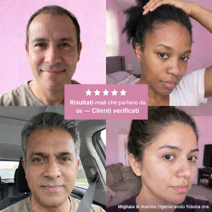 Siero PuraDama™ HairDensity | Siero roll-on per la crescita dei capelli