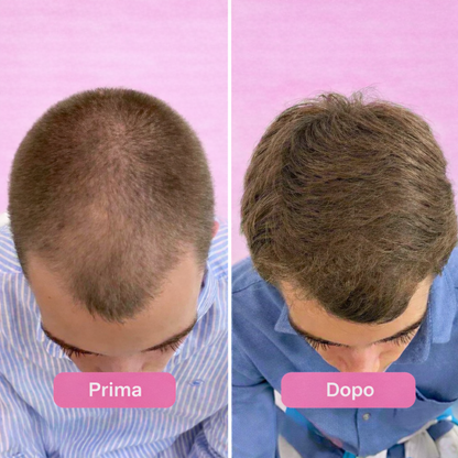 Siero PuraDama™ HairDensity | Siero roll-on per la crescita dei capelli