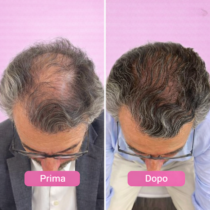 Siero PuraDama™ HairDensity | Siero roll-on per la crescita dei capelli