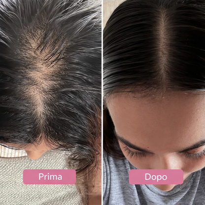 Siero PuraDama™ HairDensity | Siero roll-on per la crescita dei capelli