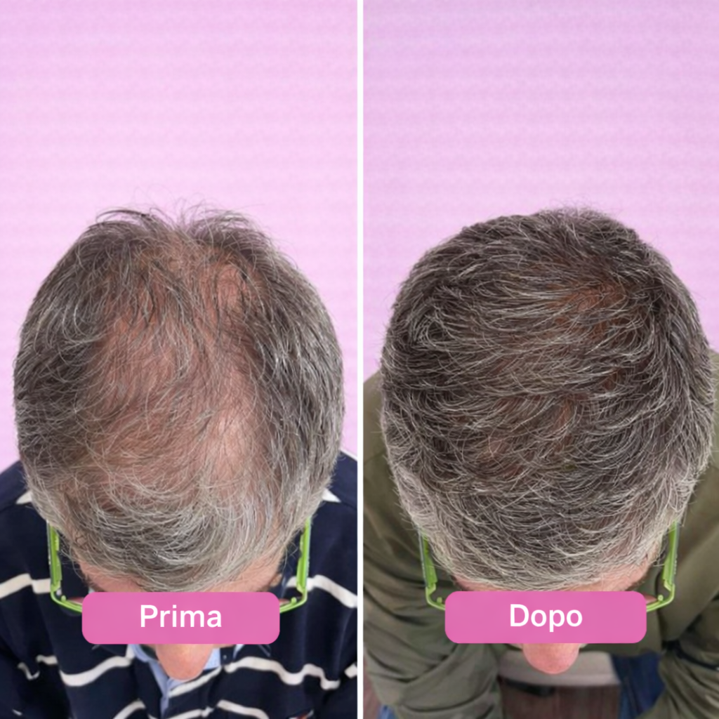 Siero PuraDama™ HairDensity | Siero roll-on per la crescita dei capelli