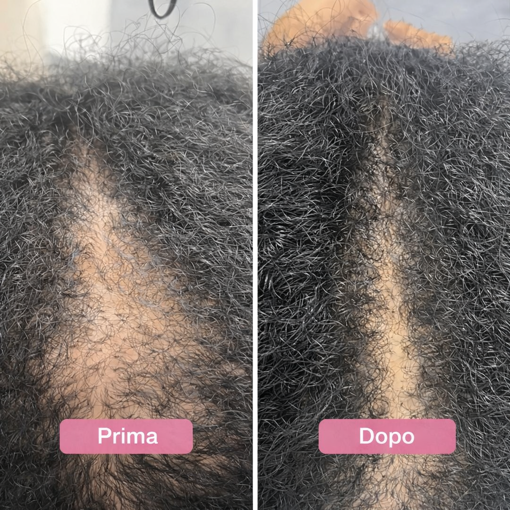 Siero PuraDama™ HairDensity | Siero roll-on per la crescita dei capelli